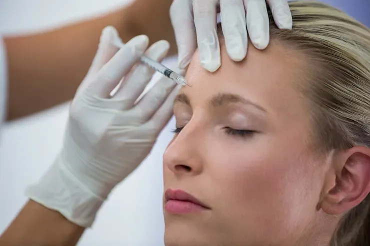 Paciente recebendo aplicação de toxina botulínica na testa Paciente recebendo aplicação de toxina botulínica na testa