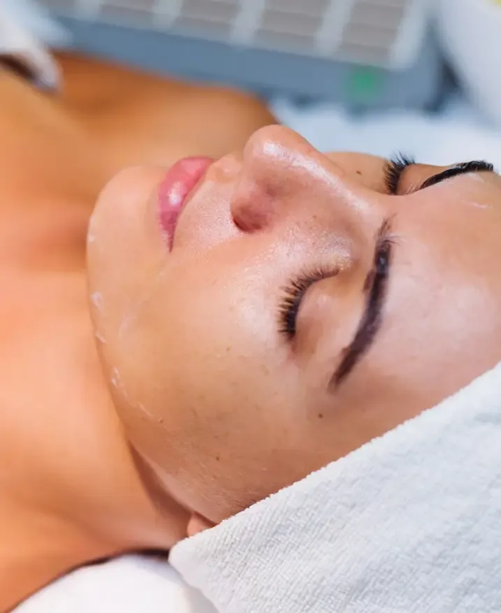 Pele com acne em avaliação para tratamento dermatológico Pele com acne em avaliação para tratamento dermatológico