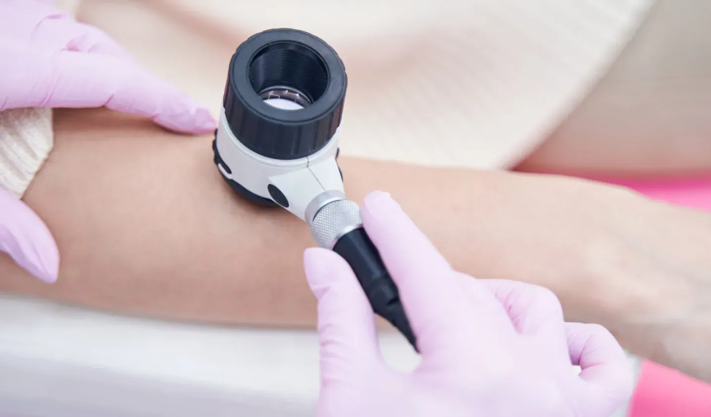Detalhe de dermatoscopia