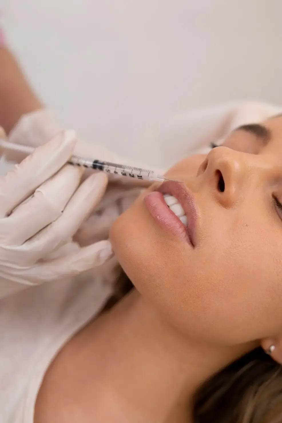 Aplicação de preenchimento labial com ácido hialurônico Aplicação de preenchimento labial com ácido hialurônico
