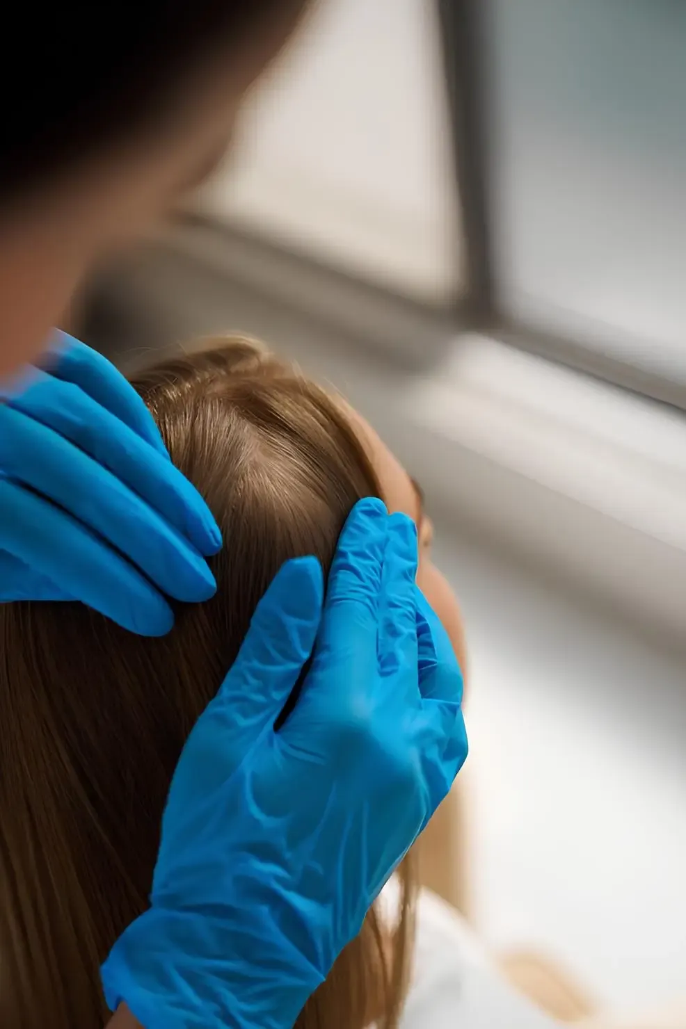 Avaliação do couro cabeludo em consulta dermatológica Avaliação do couro cabeludo em consulta dermatológica