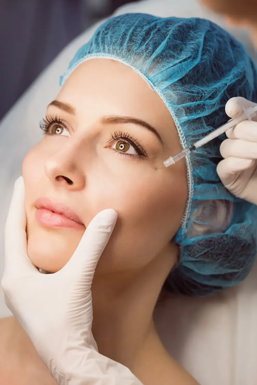 Aplicação de skinbooster na região da testa Aplicação de skinbooster na região da testa
