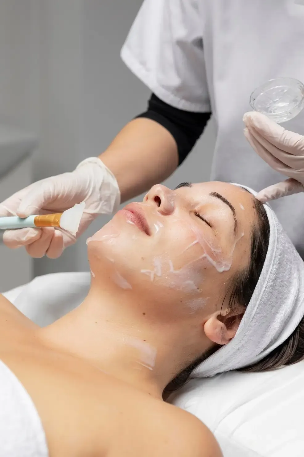 Aplicação de procedimento dermatológico para tratamento de melasma Aplicação de procedimento dermatológico para tratamento de melasma