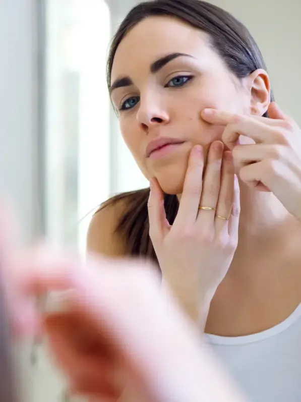 Exame da pele para avaliação dos sinais de acne Exame da pele para avaliação dos sinais de acne