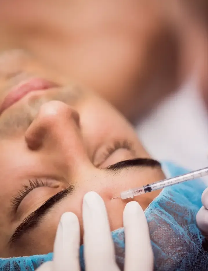 Aplicação de skinbooster para revitalização da pele em Ribeirão Preto Aplicação de skinbooster para revitalização da pele em Ribeirão Preto