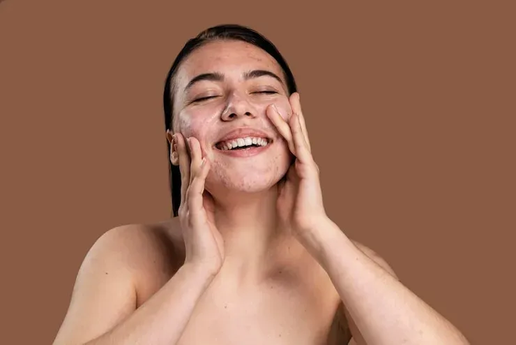 Mulher sorridente lavando o rosto com pele com acne Mulher sorridente lavando o rosto com pele com acne
