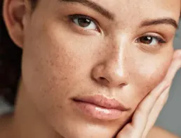 Tratamento de Melasma e Manchas